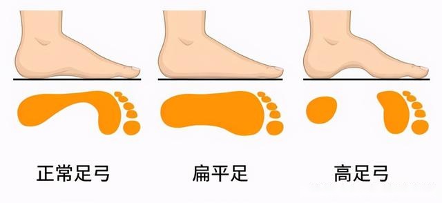 刘涛也内八字？X型腿如何破？做好这2步细直疏影腿你也有